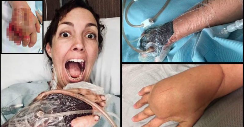 She Scratched Her Hand While Cleaning, Now She’s Lucky to Be Alive